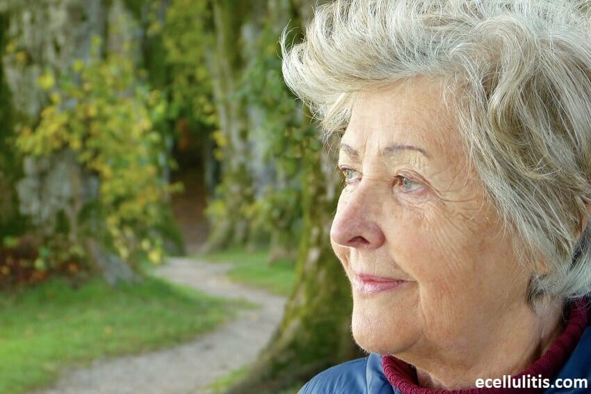 Cellulitis Affecting Older People