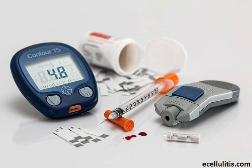 Diabetes as the Cause of Cellulitis