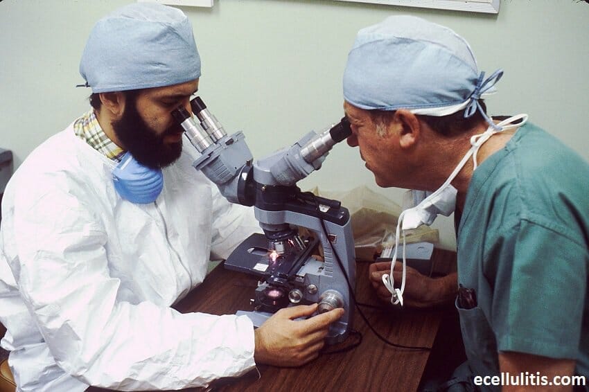 Diagnosing Cellulitis