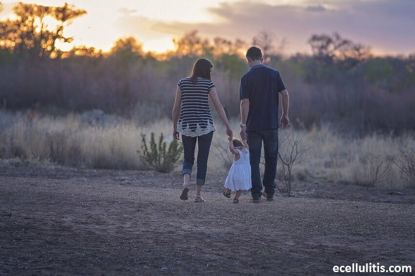 Don_t Worry About Cellulitis Being Contagious