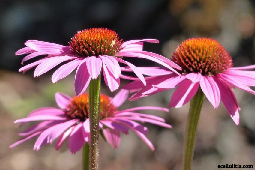 Natural Cellulitis Treatment - Echinacea
