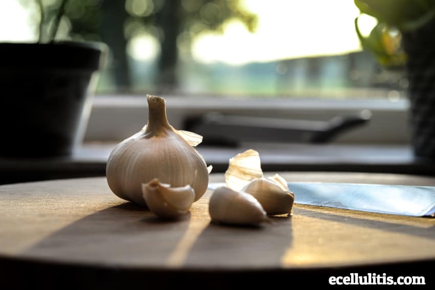 Natural Cellulitis Treatment