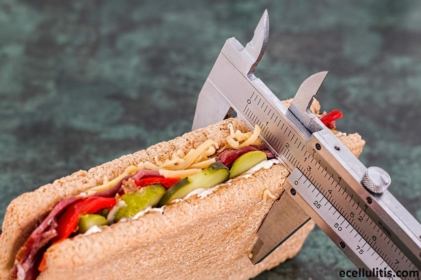 obesity and diet as causes of cellulitis