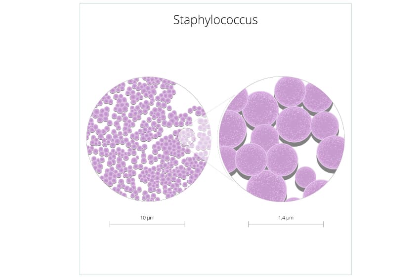 link between MRSA and Cellulitis