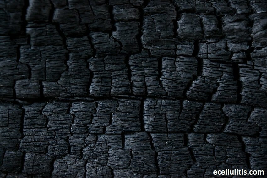 Alternative Treatments for Cellulitis - Activated Charcoal