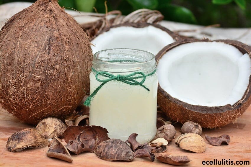 Alternative Treatments for Cellulitis - Coconut Oil
