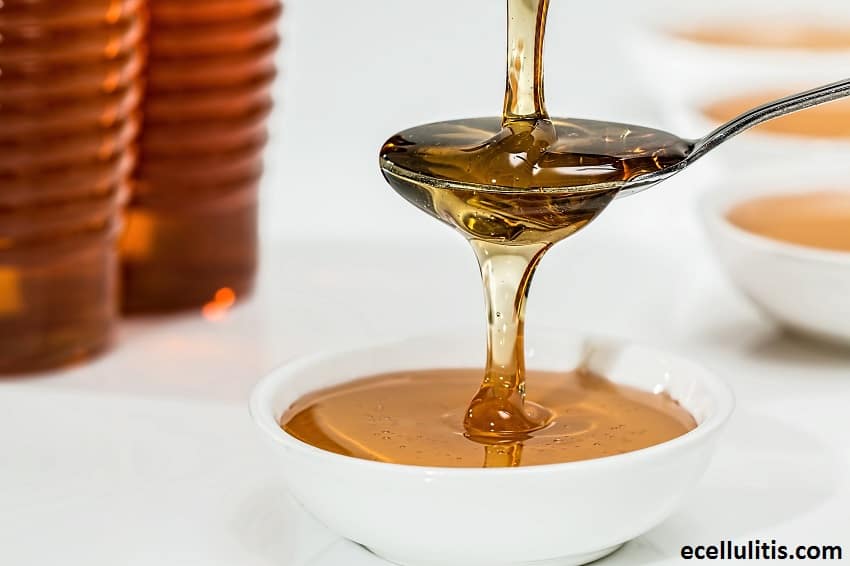 Alternative Treatments for Cellulitis - Manuka Honey