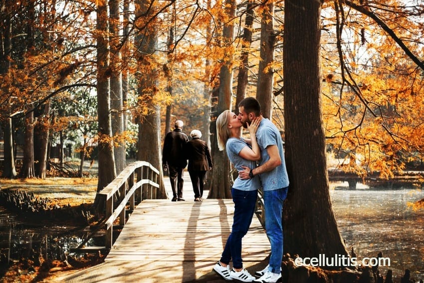 sunlight and vitamin D