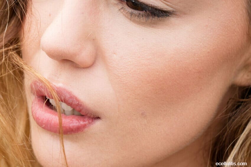home remedies for chapped lips