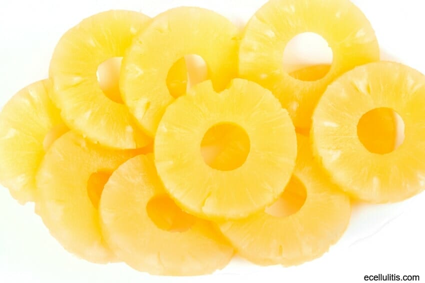 Bromelain - Natural Treatment For Cellulitis