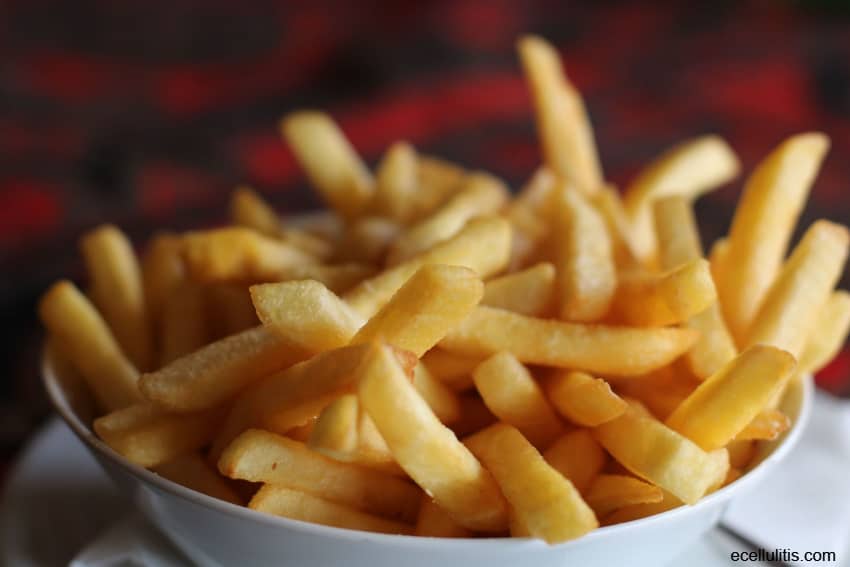  french fries - worst foods in the world