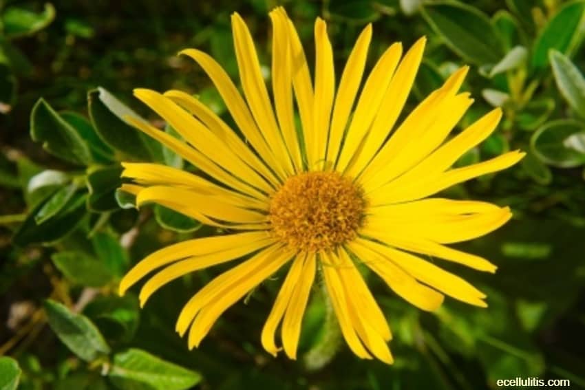 arnica bruises benefits for skin