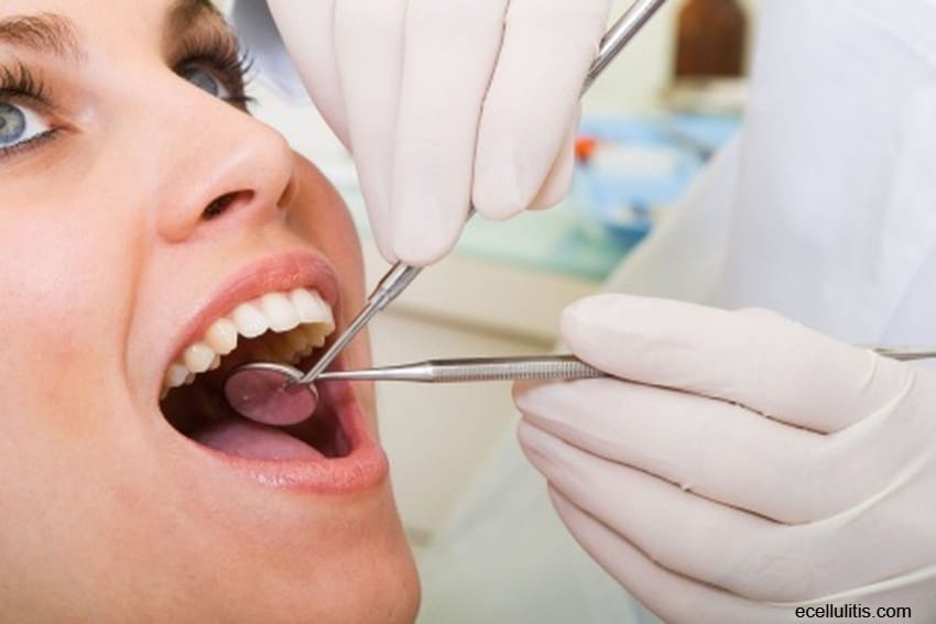 dental checkup - How To Make Bad Breath History