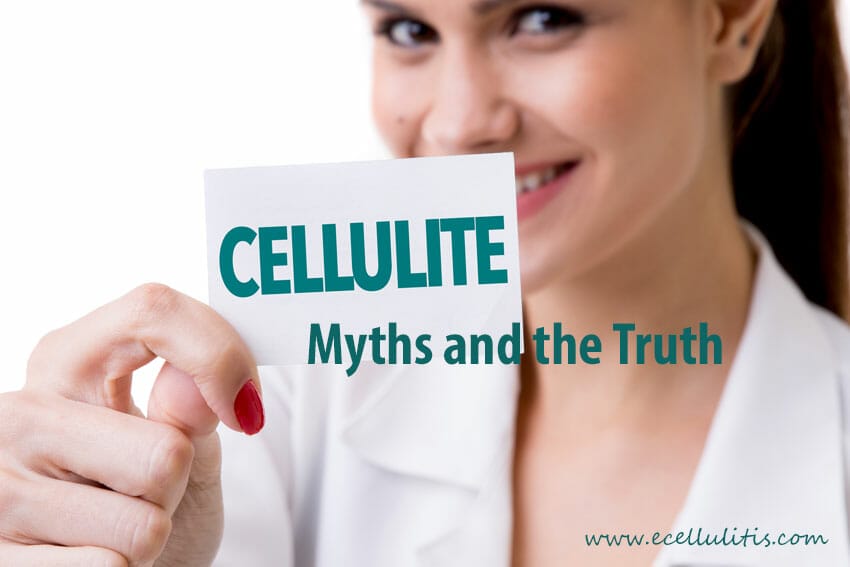 Cellulite myths and the truth