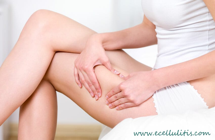 about cellulite treatmens