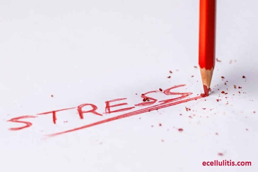 Stress Relief & Stress Management Guide – 12 Tips To Minimize Daily Stress