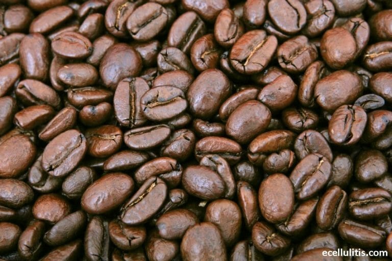 6 Natural Ways To Keep Mosquitoes Away This Summer Ecellulitis