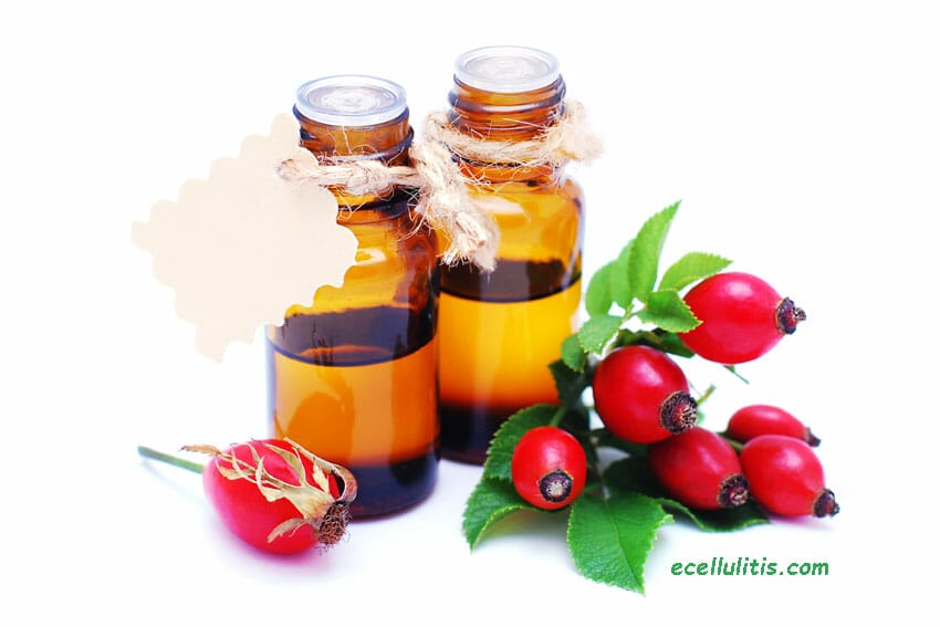 Rosehip oil - treat scars naturally