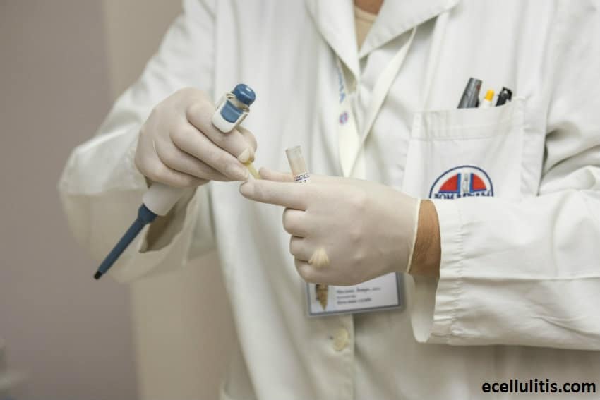 diagnosing allergies