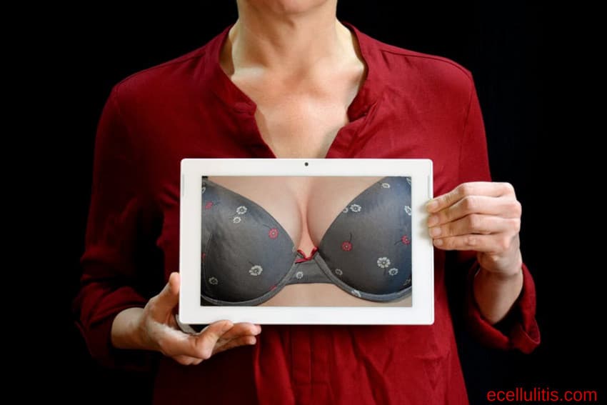 breast augmentation - how long will my breast implants last
