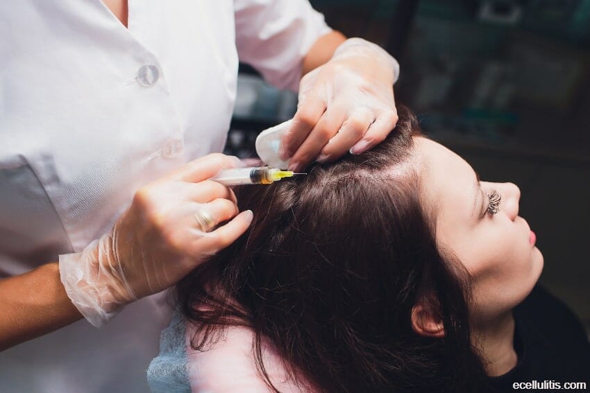 prp hair treatment - the trendiest non-surgical cosmetic treatments for 2020