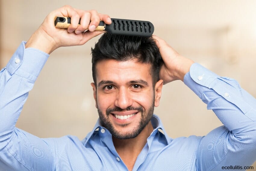 hair loss - be gentle when styling your hair