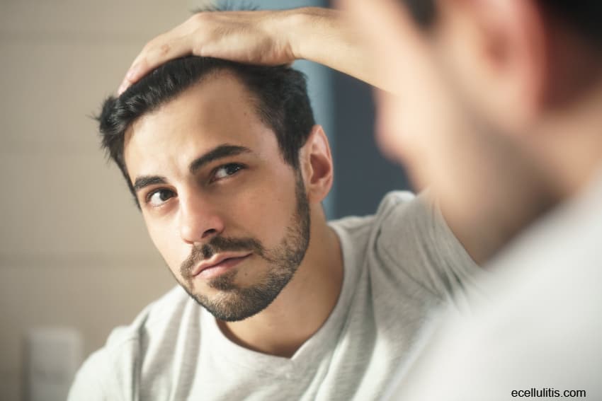 tips for preventing hair loss