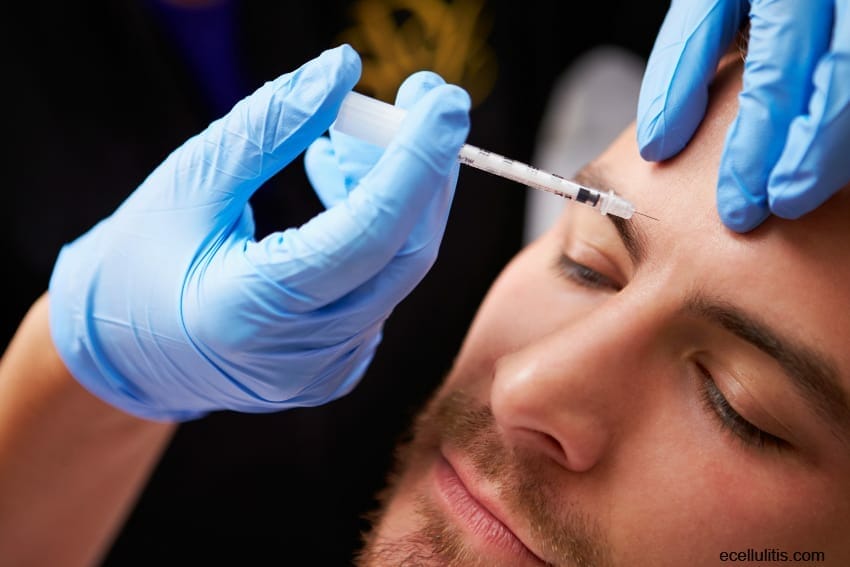 botox treatment reduces depression