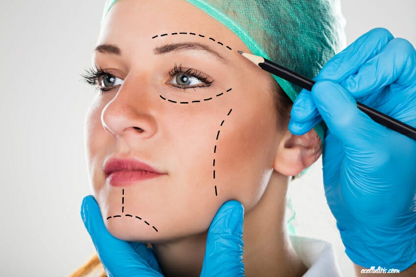 When is the Right Time for Facial Liposuction